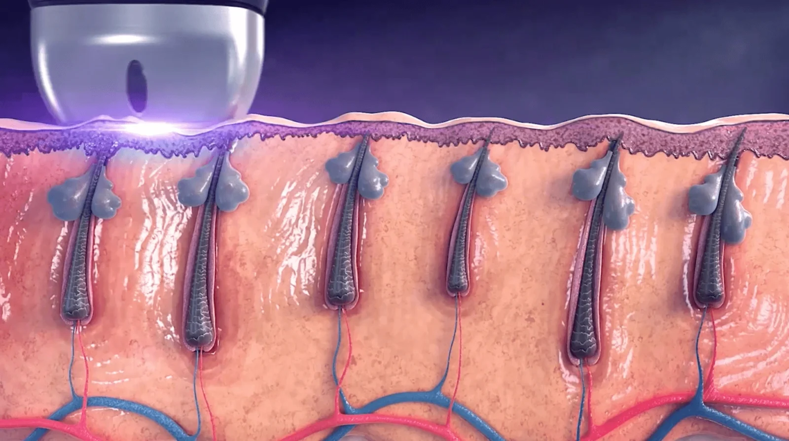 SilkySkin Technologie