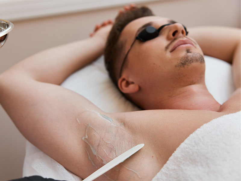 Laser Haarentfernung für Männer